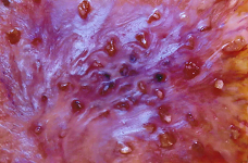 Resin pink mit Rosenquarz